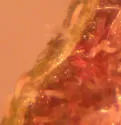 Elm Fingergall Mite