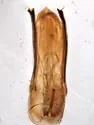 Colenis bifida