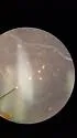 Banded Foul Water Mosquito - photo 4