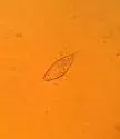 Demodex canis