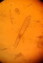 Demodex canis - photo 4