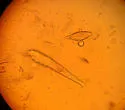 Demodex canis - photo 5
