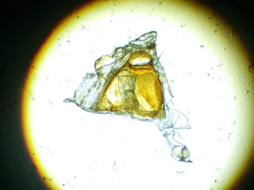 Dichrorampha petiverella - photo 8