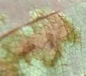 Apple Leaf Blister Mite - photo 4