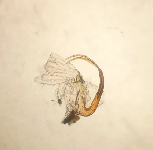 Macrosteles laevis - photo 8