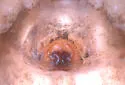 Metaphidippus iviei - photo 5