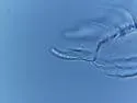 Microgastrura minutissima - photo 4