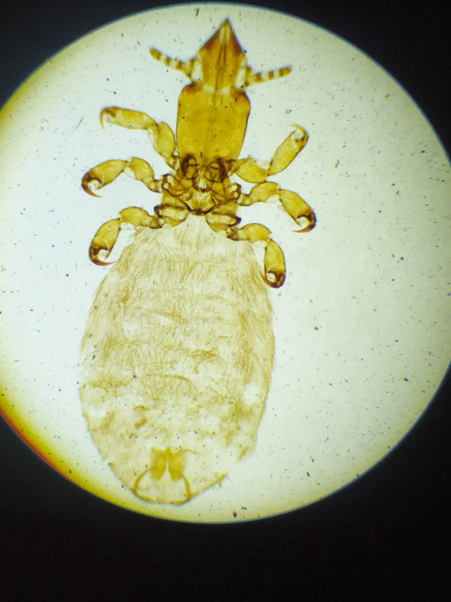 Microthoraciidae - photo 3