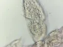 Onychiurus reluctus