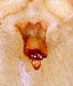 Oreonetides vaginatus - photo 3