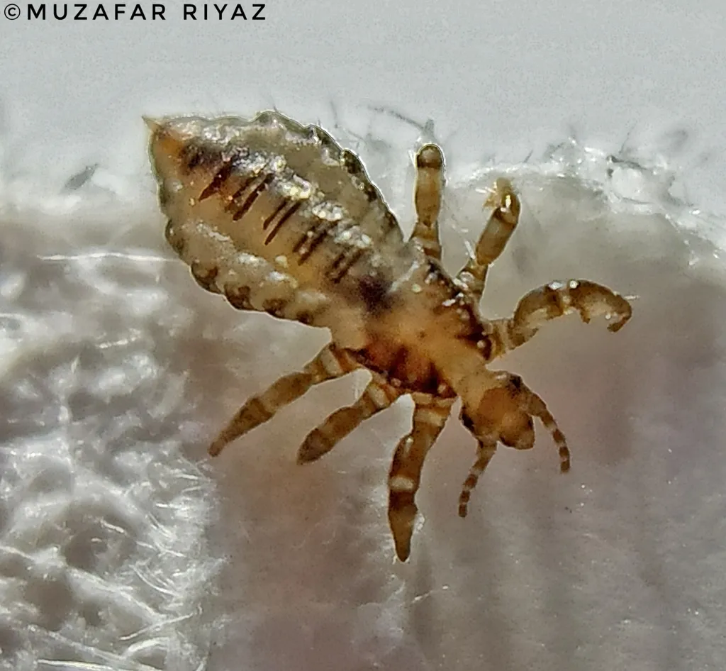 Human Louse - photo 2