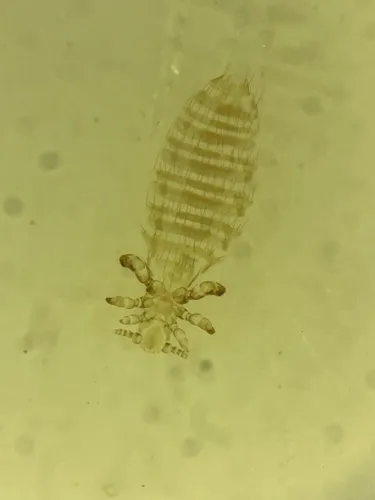 Polyplax alaskensis