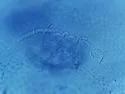 Pseudachorudina ignota - photo 5