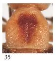 Pseudozonitis stroudi