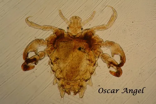 Pubic lice - photo 2