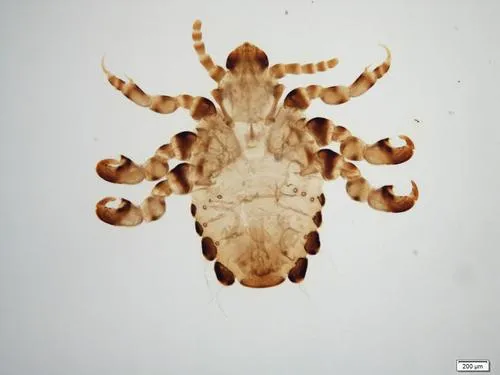 Gorilla Louse