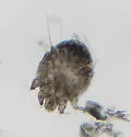 itch mite - photo 2