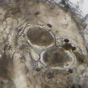 itch mite - photo 3