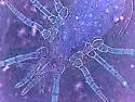 Western predatory mite